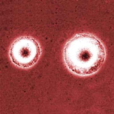 Mycoplasma Market Size & Share to Rise at Significant CAGR for Forecast Year 2022-2030