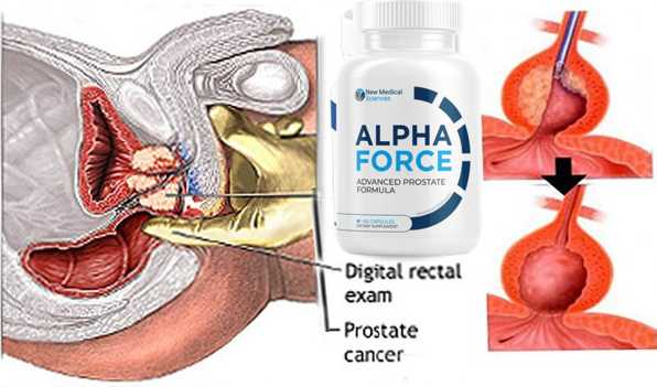 Alpha Force Prostate Formula Reviews -What If It Doesn't Work For Me? & Shocking Side Effects !